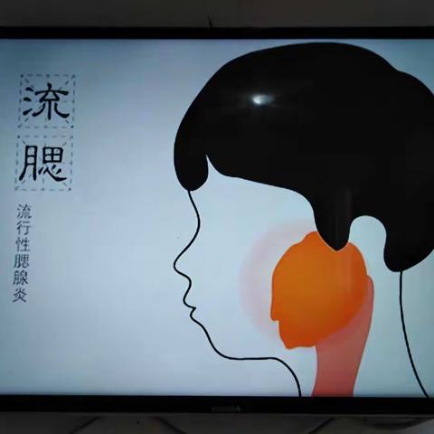 海口市龙桥镇中心幼儿园宝宝班健康活《预防腮腺炎》