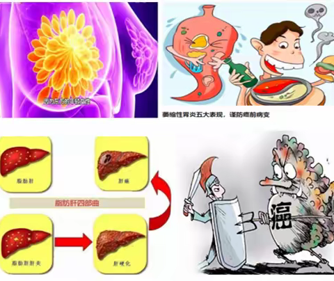 蔡工康家无界: 2:乳腺结节,胃溃疡、胃息肉和萎缩性胃炎…都是因为它！