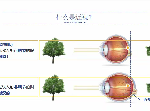 潍坊高新区（上海）新纪元学校 近视防控《致家长的一封信》